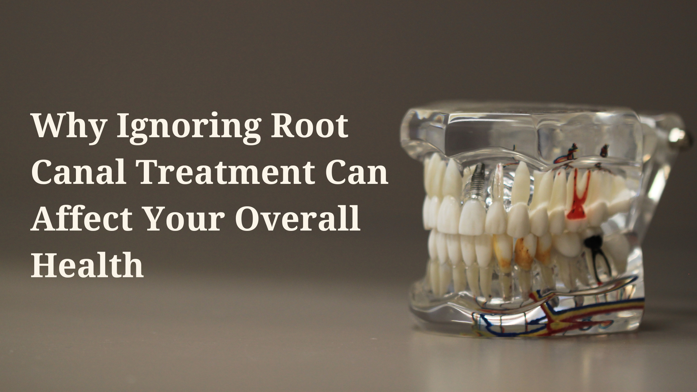 Why Ignoring Root Canal Treatment Can Affect Your Overall Health